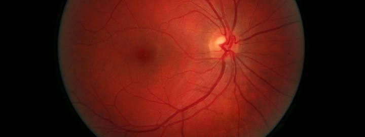 В клинике 3Z Ессентуки начали выполнять витреоретинальные операции